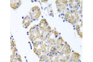Immunohistochemistry of paraffin-embedded Human stomach using GLS Polyclonal Antibody at dilution of 1:100 (40x lens).