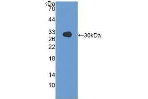 Detection of Recombinant GSTa3, Gallus using Polyclonal Antibody to Glutathione S Transferase Alpha 3 (GSTa3)