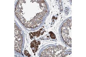 Immunohistochemical staining of human testis with WIPF3 polyclonal antibody  shows moderate cytoplasmic positivity in cells in seminiferus ducts and strong staining in Leydig cells at 1:50-1:200 dilution. (WIPF3 anticorps)