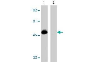 Western blot analysis using CX3CR1 polyclonal antibody  at 1 ug/mL on THP-1 cell lysate in the absence (lane 1) and presence (lane 2) of specific blocking peptide. (CX3CR1 anticorps  (AA 175-189))