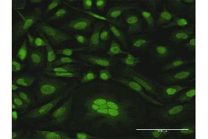 Immunofluorescence of purified MaxPab antibody to CDKN2D on HeLa cell. (CDKN2D anticorps  (AA 1-166))