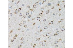 Immunohistochemistry of paraffin-embedded Rat brain using UBE2D1 Polyclonal Antibody at dilution of 1:100 (40x lens).