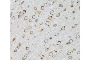 Immunohistochemistry of paraffin-embedded Rat brain using UBE2D1 Polyclonal Antibody at dilution of 1:100 (40x lens). (UBE2D1 anticorps)