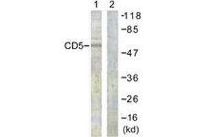 Western Blotting (WB) image for anti-CD5 (CD5) (AA 421-470) antibody (ABIN2888797) (CD5 anticorps  (AA 421-470))