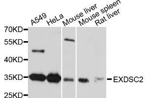 Western blot analysis of extracts of various cell lines, using EXOSC2 antibody. (EXOSC2 anticorps)