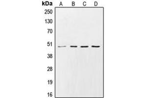Western blot analysis of CK1 gamma 2 expression in HeLa (A), Raw264. (Casein Kinase 1 gamma 2 anticorps  (N-Term))