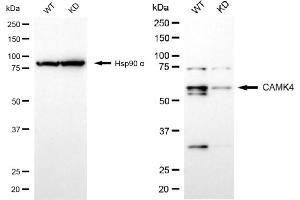 Western blotting analysis using CAMK4 antibody (ABIN7797838).
