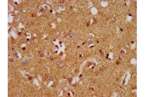IHC image of ABIN7159750 diluted at 1:400 and staining in paraffin-embedded human brain tissue performed on a Leica BondTM system. (MAP1A anticorps  (AA 1979-2168))