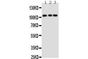 Anti-TRPC6 antibody, Western blotting Lane 1: Rat Lung Tissue Lysate Lane 2: 293T Cell Lysate Lane 3: 293T Cell Lysate