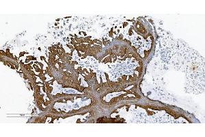 IHC analysis of PLTP using anti-PLTP antibody (ABIN7600346). (PLTP anticorps  (AA 18-470))