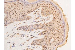 ABIN6267289 at 1/100 staining human skin tissue sections by IHC-P.