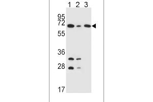 DLAT Antibody (C-term) (ABIN651534 and ABIN2840283) western blot analysis in K562(lane 1),HepG2(lane 2),Jurkat(lane 3) cell line lysates (35 μg/lane). (DLAT anticorps  (C-Term))