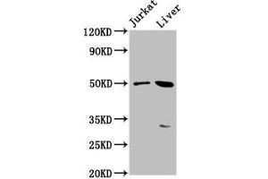 Western Blot Positive WB detected in: Jurkat whole cell lysate, Mouse liver tissue All lanes: BPIFB3 antibody at 3. (BPIFB3 anticorps  (AA 248-352))