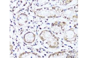Immunohistochemistry of paraffin-embedded Human stomach using EGLN1/EGLN2 Polyclonal Antibody at dilution of 1:100 (40x lens). (EGLN1 anticorps)