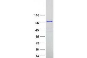 Validation with Western Blot