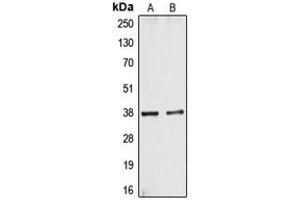 Western blot analysis of CYSLTR1 expression in A10 (A), HT29 (B) whole cell lysates. (CysLTR1 anticorps  (Center))