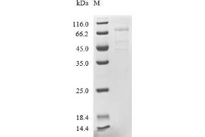 (Tris-Glycine gel) Discontinuous SDS-PAGE (reduced) with 5 % enrichment gel and 15 % separation gel.