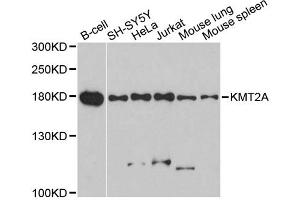 Western blot analysis of extracts of various cell lines, using KMT2A antibody. (MLL/KMT2A anticorps)
