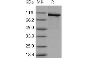 Western Blotting (WB) image for Poly (ADP-Ribose) Polymerase 1 (PARP1) (Active) protein (His tag) (ABIN7320158)