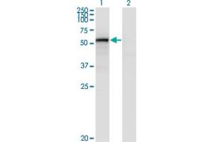 Western Blot analysis of ENG expression in transfected 293T cell line by ENG monoclonal antibody (M01), clone 4C11. (Endoglin anticorps  (AA 27-658))
