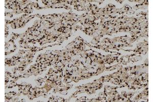ABIN6273210 at 1/100 staining Human lung tissue by IHC-P. (CNOT10 anticorps  (Internal Region))