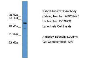 WB Suggested Anti-SYT2  Antibody Titration: 0. (SYT2 anticorps  (C-Term))