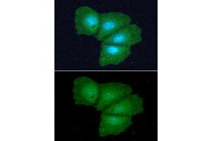 ICC/IF analysis of ADI1 in Hep3B cells line, stained with DAPI (Blue) for nucleus staining and monoclonal anti-human ADI1 antibody (1:100) with goat anti-mouse IgG-Alexa fluor 488 conjugate (Green).