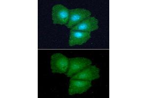 ICC/IF analysis of ADI1 in Hep3B cells line, stained with DAPI (Blue) for nucleus staining and monoclonal anti-human ADI1 antibody (1:100) with goat anti-mouse IgG-Alexa fluor 488 conjugate (Green). (ADI1 anticorps)
