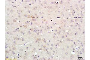 Formalin-fixed and paraffin embedded rat brain labeled with Anti-FGFR3/CD333 Polyclonal Antibody, Unconjugated (ABIN674664) at 1:200 followed by conjugation to the secondary antibody and DAB staining (FGFR3 anticorps  (AA 501-600))