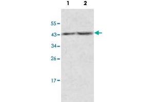 Western blot analysis of human fetal kidney (Lane 1) and fetal thymus (Lane 2) lysate with ACOT9 polyclonal antibody  at 1 : 500 dilution. (ACOT9 anticorps  (AA 3-212))