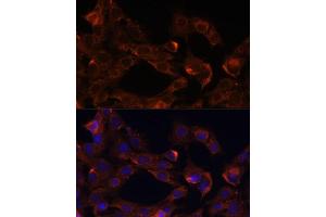 Immunofluorescence analysis of C6 cells using Neuropilin-1 (Neuropilin-1 (NRP1)) antibody (ABIN7268892) at dilution of 1:100. (Neuropilin 1 anticorps  (AA 21-250))