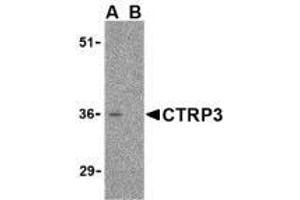 Western blot analysis of CTRP3 in mouse heart cell lysate with AP30251PU-N CTRP3 antibody at 1 μg/ml in the (A) absence and (B) presence of blocking peptide.