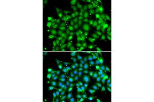 Immunofluorescence analysis of MCF7 cell using SUFU antibody. (SUFUH anticorps)