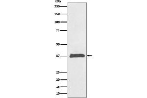 Western blot analysis of BMP2 expression in HeLa cell lysate.