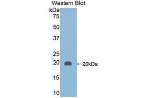Western Blotting (WB) image for anti-Haptoglobin (HP) (AA 118-281) antibody (ABIN1078101) (Haptoglobin anticorps  (AA 118-281))