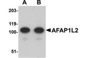 Western Blotting (WB) image for anti-Actin Filament Associated Protein 1-Like 2 (AFAP1L2) (C-Term) antibody (ABIN1030225) (AFAP1L2 anticorps  (C-Term))