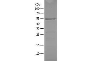 Western Blotting (WB) image for TNF Receptor-Associated Factor 2 (TRAF2) (AA 306-501) protein (His-IF2DI Tag) (ABIN7125407)
