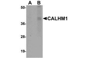 Western blot analysis of CALHM1 in rat liver tissue lysate with AP30176PU-N CALHM1 antibody at (A) 1 and (B) 2 μg/ml. (CALHM1 anticorps  (N-Term))