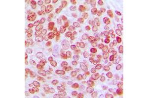 anti-Ets2 Repressor Factor (ERF) (C-Term) antibody