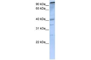 WB Suggested Anti-PCAF Antibody Titration: 0. (KAT2B anticorps  (C-Term))