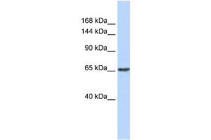WB Suggested Anti-ZNF91 Antibody Titration:  0.