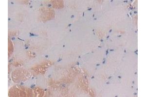 Detection of MCSF in Mouse Skeletal muscle Tissue using Polyclonal Antibody to Colony Stimulating Factor 1, Macrophage (MCSF)