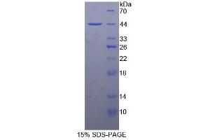SDS-PAGE analysis of Rat Nephrin Protein. (Nephrin Protéine)