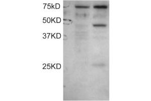 Western Blotting (WB) image for anti-Dyslexia Susceptibility 1 Candidate 1 (DYX1C1) (C-Term) antibody (ABIN2465629) (DYX1C1 anticorps  (C-Term))