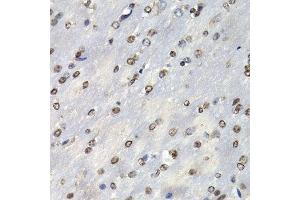 Immunohistochemistry of paraffin-embedded mouse brain using PSMB10 antibody at dilution of 1:200 (400x lens). (PSMB10 anticorps)