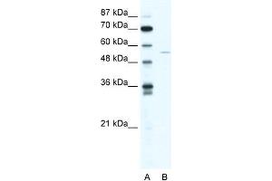 Human HepG2; WB Suggested Anti-ZNF289 Antibody Titration: 1. (arfgap2 anticorps  (N-Term))