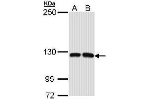WB Image Sample (30 ug of whole cell lysate) A: Molt-4 , B: Raji 5% SDS PAGE antibody diluted at 1:1000 (MCF2L anticorps  (N-Term))