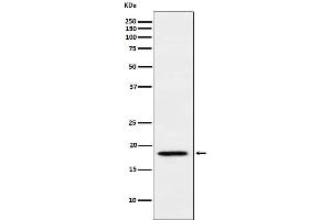 Western blot analysis of MTH1 expression in Jurkat cell lysate.