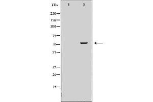Western blot analysis of extracts of HepG2 , using SLC1A4antibody. (SLC1A4 anticorps  (C-Term))