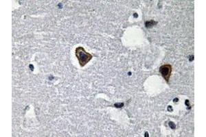 Immunohistochemistry analyzes of Sarcoglycan-β antibody in paraffin-embedded human brain tissue. (SGCB anticorps)